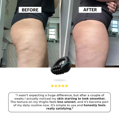 BodySculpt — Cellulite Massager