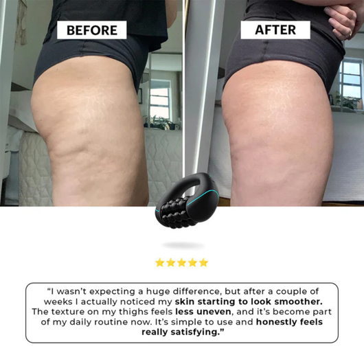 BodySculpt — Cellulite Massager